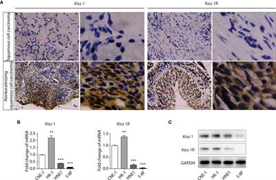 <mark class="highlighted">Kiss1</mark> Inhibits the Proliferation of Nasopharyngeal Carcinoma Cells Via Activation of the LKB1/AMPK Pathway